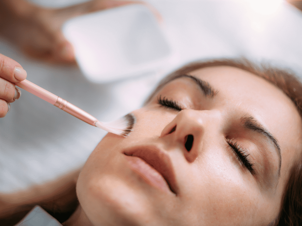 Elegant facial peel treatment in Lubbock at The Spa by Sheena, showcasing glowing skin results.