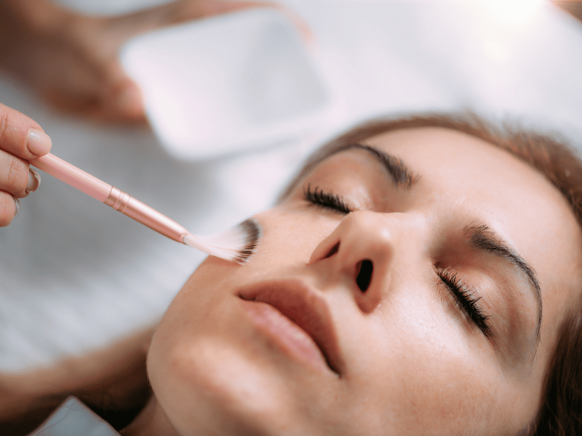 Elegant facial peel treatment in Lubbock at The Spa by Sheena, showcasing glowing skin results.